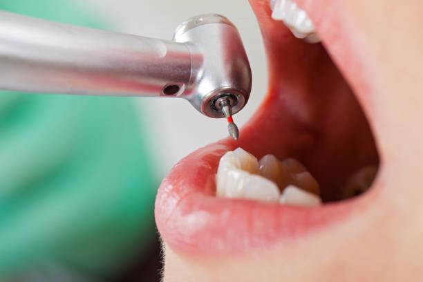 Tooth Infection Emergency Dentist in KS